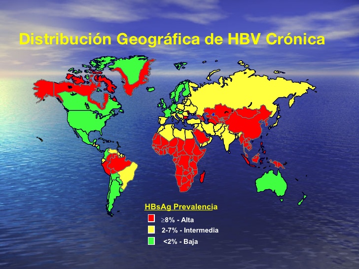 Mapa mundial de la incidencia de la hepatitis A Mapa mundial de la incidencia de la hepatitis A